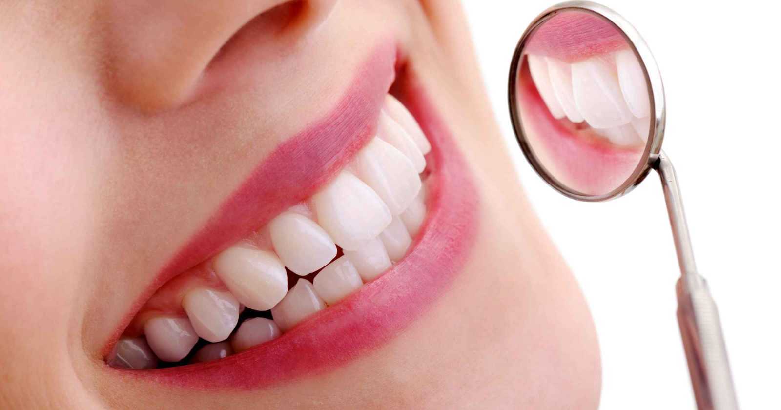 Clareamento Dental